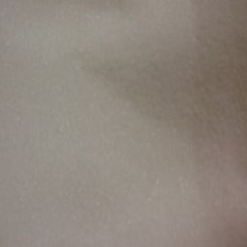 Sugar